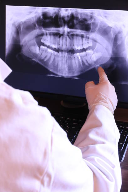 Best Weekend Emergency Dental Services in Upland, IN
